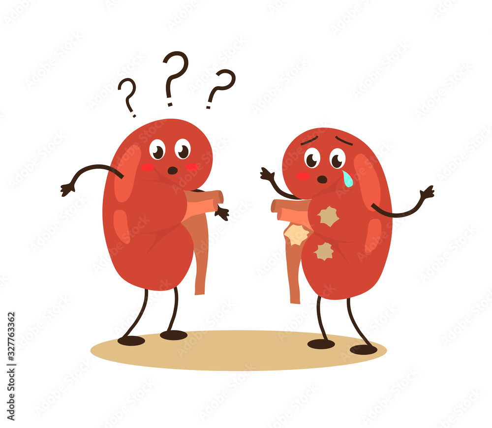 Obraz premium Sick human kidneys on a white background. Stones in the kidneys. Vector illustration.