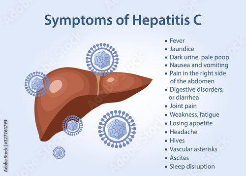 Hepatitis liver. Symptoms of hepatitis C as text. Vector illustration in flat style isolated on blue background. photo