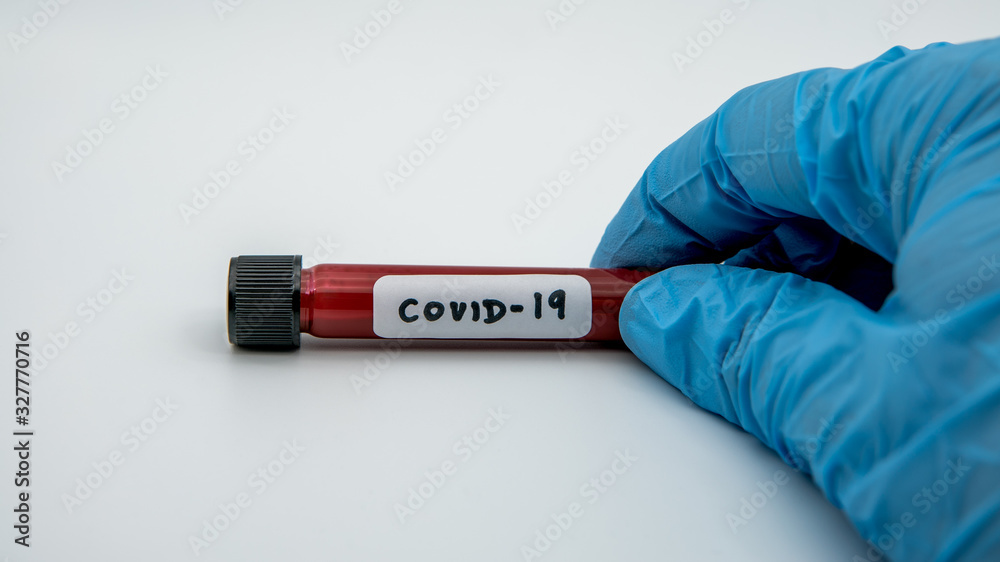 Obraz premium Surgical gloves with a positive coronavirus infected blood sample test.