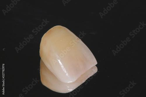 ジルコニアクラウン zirconic crown