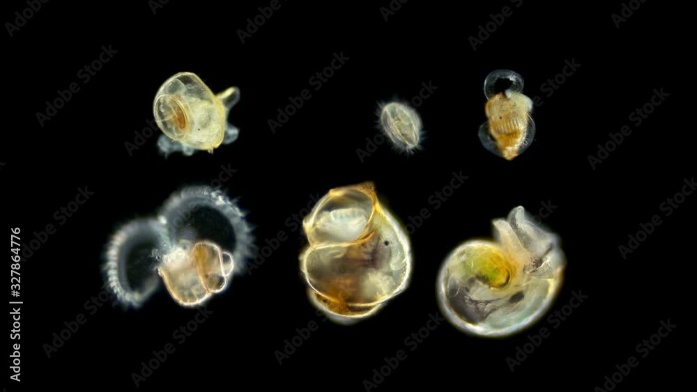 Larvae of a sea snail different types under the microscope, called