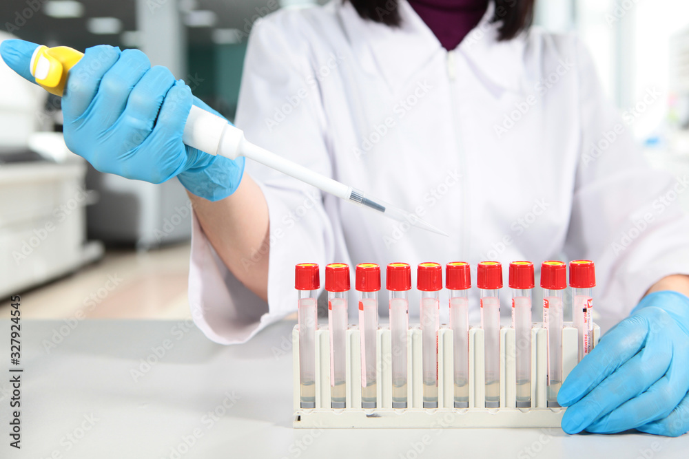 Laboratory assistant's hand in protective gloves with a pipette. Medical research. The threat of coronavirus. op view Laboratory assistant's hand in protective gloves with a pipette. Medical research. The threat of coronavirus. op view