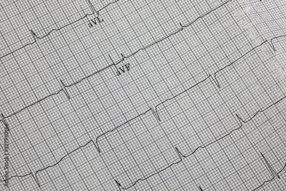 6. EKG Heart Monitor Nails - wide 8