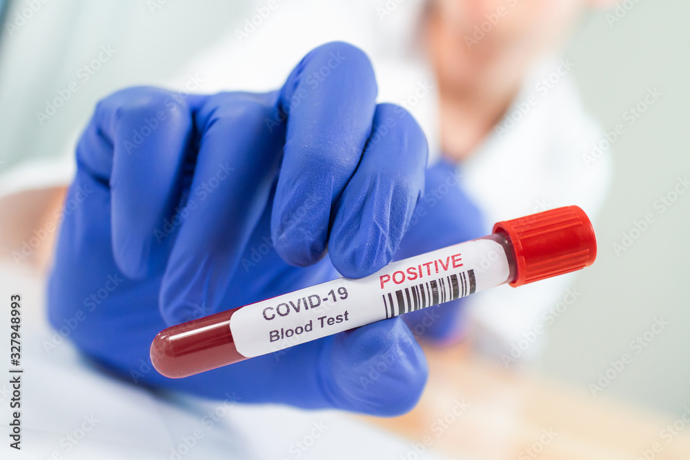 Coronavirus COVID-19 Infected Blood Sample in Doctor Scientist Hands. Epidemic and Virus Outbreak. Coronavirus COVID-19 Infected Blood Sample in Doctor Scientist Hands. Epidemic and Virus Outbreak.