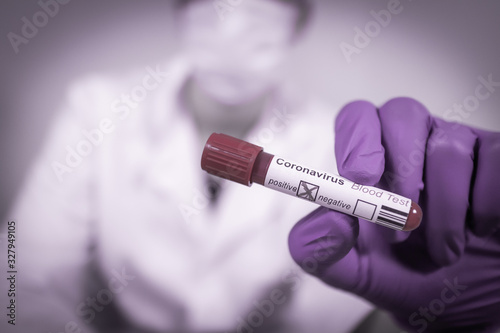 Coronavirus COVID-19 Infected Blood Sample in Doctor Scientist Hands. Epidemic and Virus Outbreak.