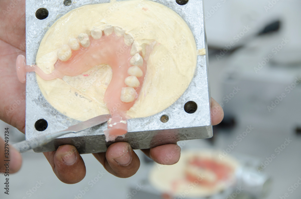 Dental laboratory, acrylic injection work for dental prostheses