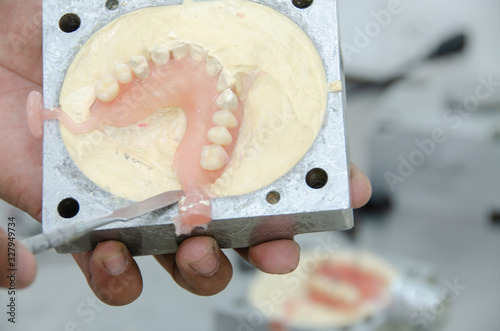 Obraz na płótnie Dental laboratory, acrylic injection work for dental prostheses w salonie