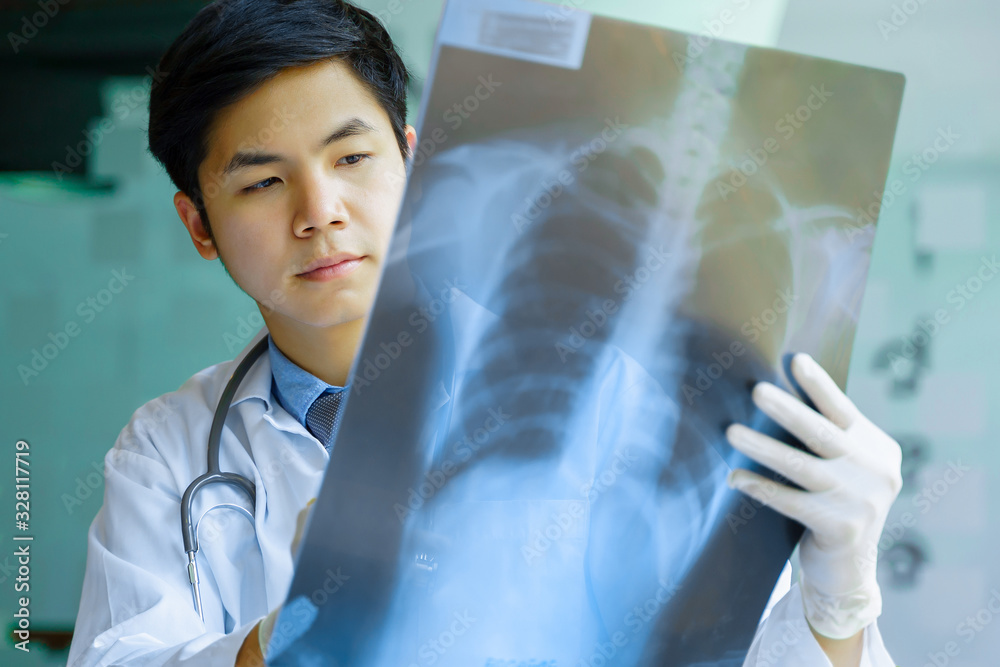 Doctor checking examining viral infection or pneumonia lesion on Chest Xray film. Coronavirus