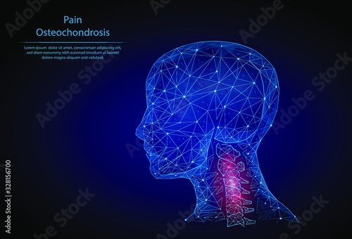 Abstract image Osteochondrosis in the form of a starry sky or space, consisting of points, lines, and shapes in the form of planets, stars and the universe. 3D Low poly vector. Neck pain. Head, spine.