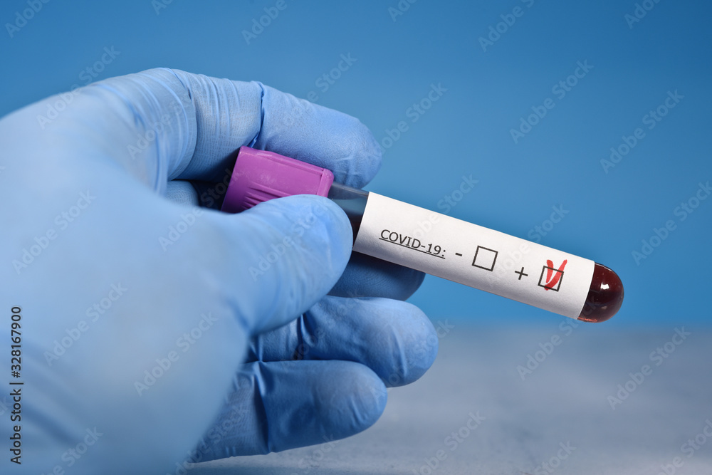 Obraz premium sciences santé virus grippe coronavirus covid-19