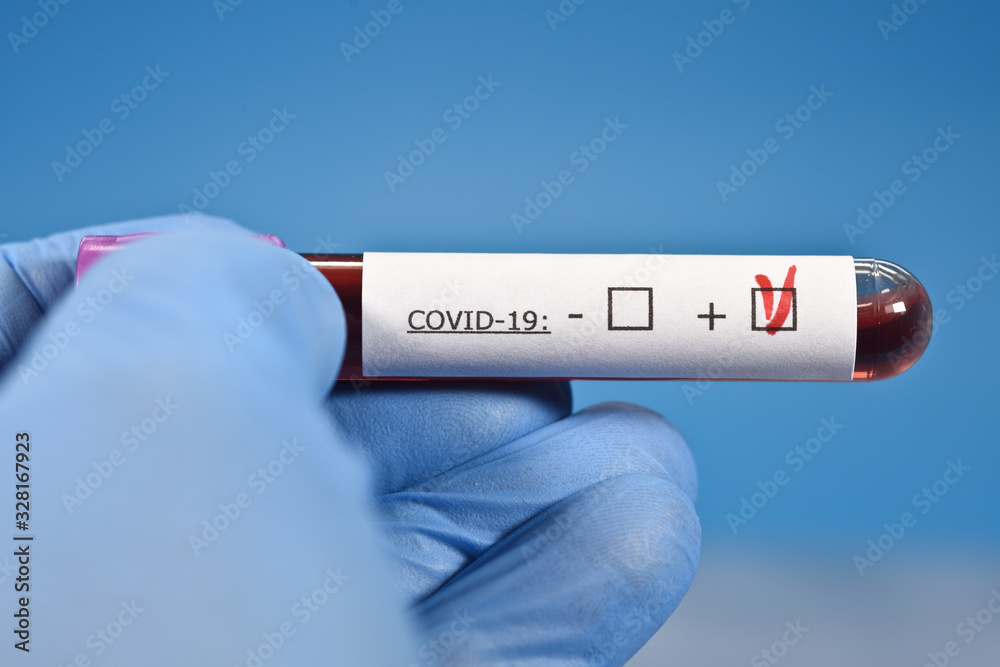 Obraz premium sciences santé virus grippe coronavirus covid-19