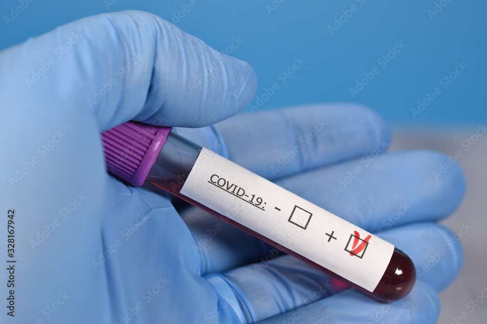 Obraz premium sciences santé virus grippe coronavirus covid-19
