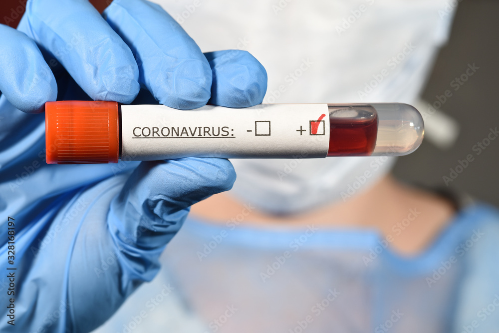 sciences santé virus grippe coronavirus covid-19 sciences santé virus grippe coronavirus covid-19