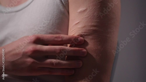 Closeup tilt up shot of a Caucasian man wearing white tank top sitting on a chair inside a room and rubbing his biceps that has multiple scars