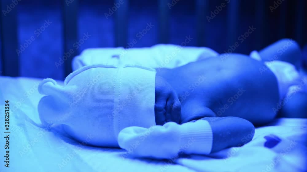 Newborn having a treatment for jaundice under ultraviolet light, Baby