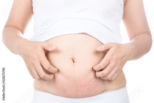  itch and pain of pregnant belly