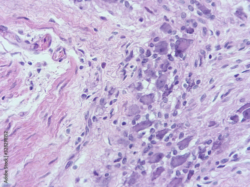 picture of histology human tissue with microscope from laboratory (not Illustration Designation)