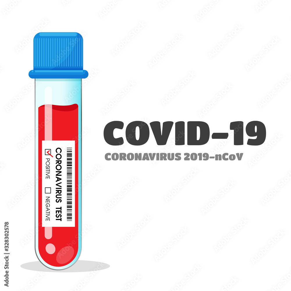 Test tubes that collect blood samples from patients with the corona virus. Test tubes that collect blood samples from patients with the corona virus.