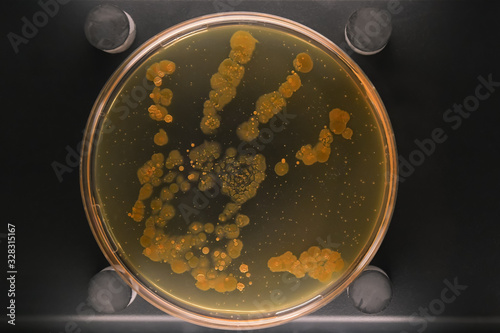 Petri dish with a colony of bacteria on a dirty hand photo