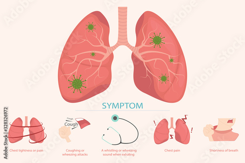 Stop coronavirus and symptoms of the disease, cough. CoVID-19 Virus outbreak spread. Breathing and examining the lungs.