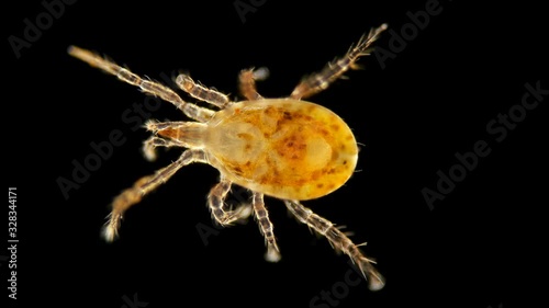 Mite of the order Mesostigmata under a microscope, class Arachnida, superorder Parasitiformes, this group has many parasites, predators and saprotrophs are also numerous, on the back we can distinguis photo