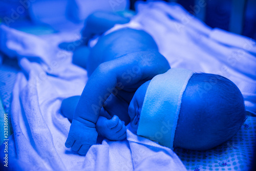 Newborn having a treatment for jaundice under ultraviolet lamp in home bed