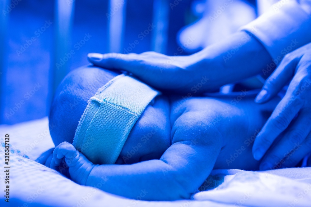 Newborn having a treatment for jaundice under ultraviolet lamp in home bed