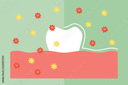 Compare tooth between by protection and not protection bacteria, microbe or virus around teeth - dental cartoon vector flat style