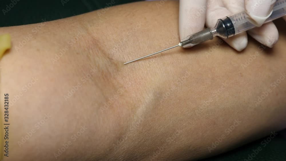 A laboratoty technician taking blood sample from the patient. Closeup view, slow motion action. A laboratoty technician taking blood sample from the patient. Closeup view, slow motion action.