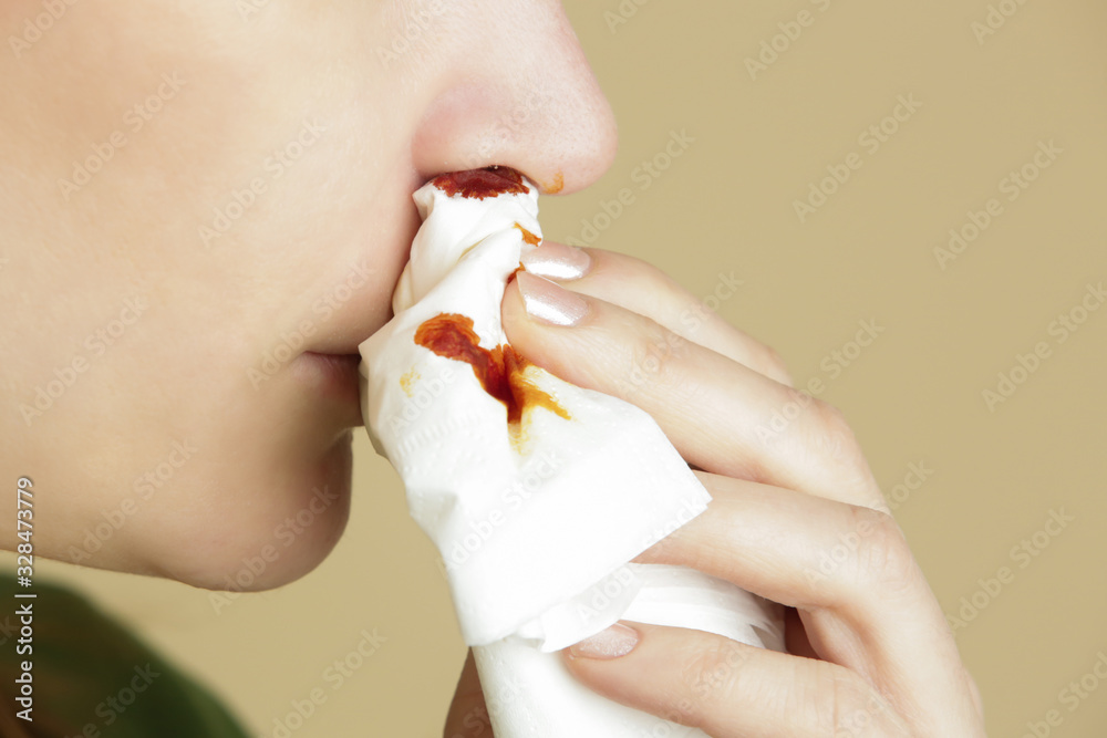 Nosebleed, a young woman with a bloody nose. Healthcare and medical concept. Close up studio image. Nosebleed, a young woman with a bloody nose. Healthcare and medical concept. Close up studio image.