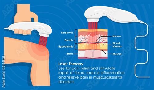 Laser Pain Therapy Handheld Portable Electronic Device for Relief Pain