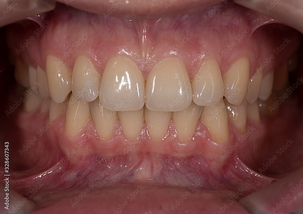 Obraz premium picture of the human jaw macro