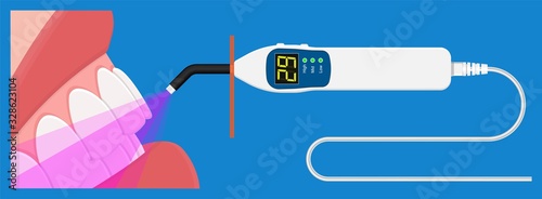 dental curing light  resin based composites fill teeth clinic treatment surgery white diagnose orthodontic assistance stomatologist stomatological