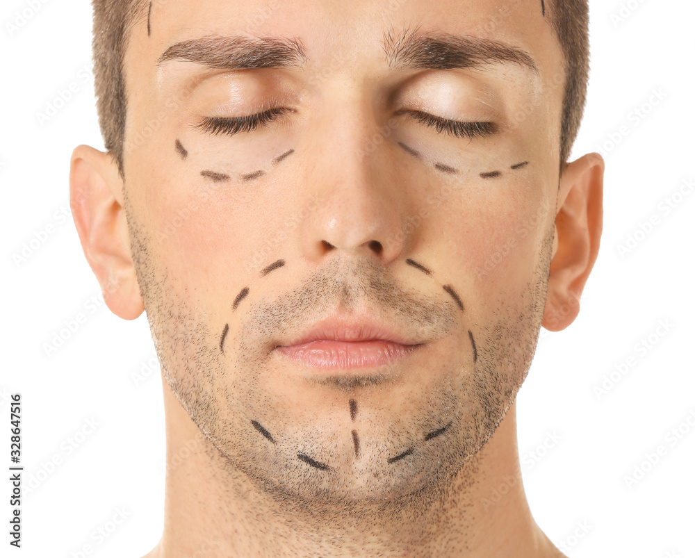 Obraz premium Young man with marks on his face against white background, closeup. Concept of plastic surgery