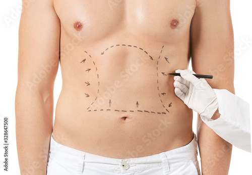 Plastic surgeon applying marking on male body against white background