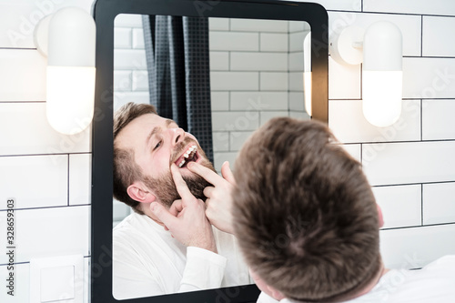 Man looks in the mirror, he opened mouth and examines the absence of a tooth that the dentist recently removed.