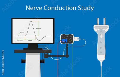 Myasthenia gravis (MG) disease treatment diagnosis testing Electroneuromyography Bell’s palsy Electromyogram problem muscular Motor Carpal tunnel syndrome Cubital Guillain Barre Peripheral neuropathy