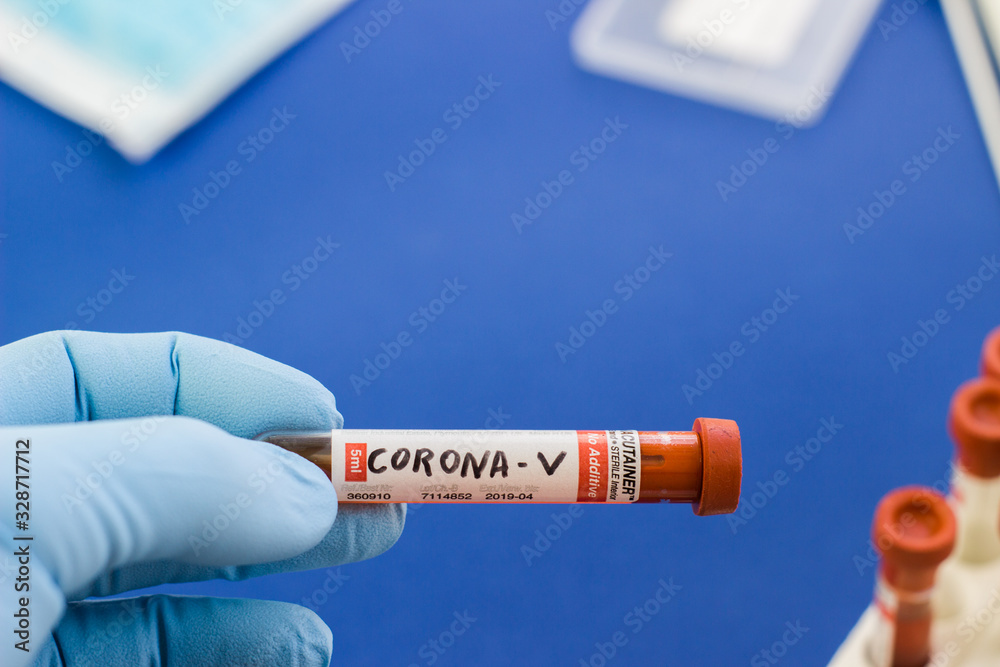 Fototapeta premium blood test tube to examine the corona virus