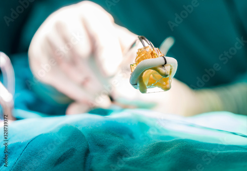 Aortic valve implant. Close up vew on artificial heart prosthesis photo