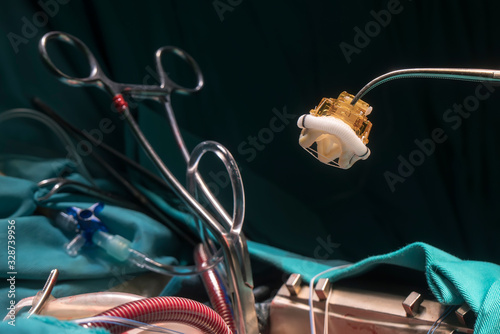 Heart valve prosthesis. Image of aortic valve implant during open heart surgery.