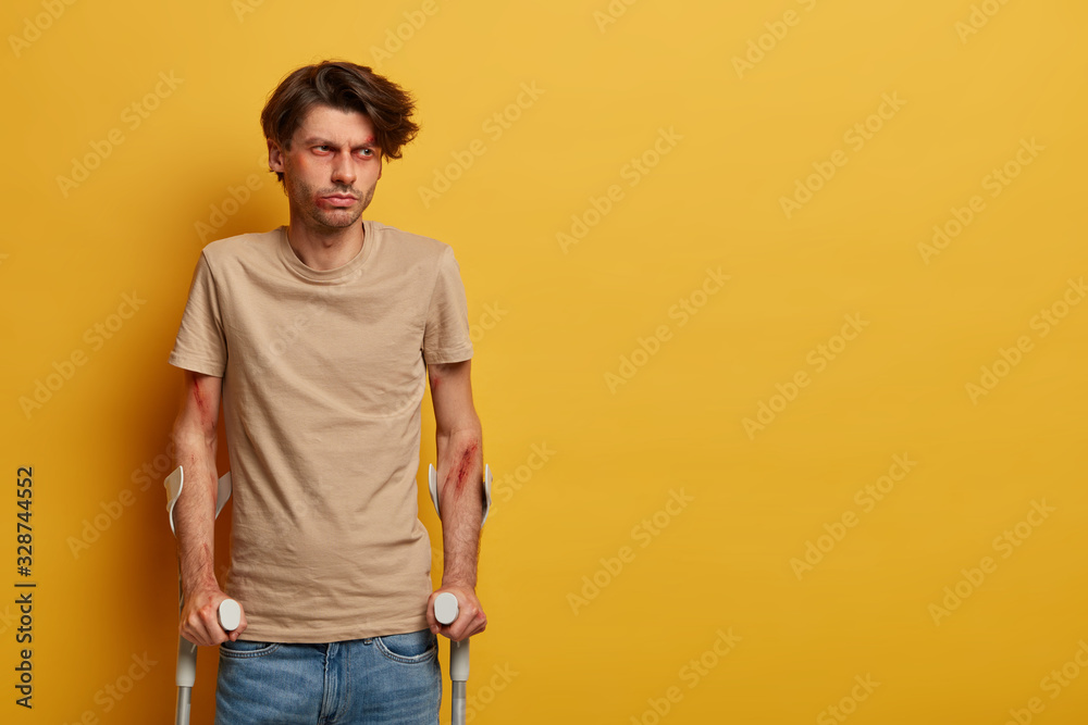 Disabled injured man has broken or sprained ankle, poses with crutches, recovers after dangerous riding on bike, needs surgery, has bruised face and arms, isolated on yellow wall, blank space Disabled injured man has broken or sprained ankle, poses with crutches, recovers after dangerous riding on bike, needs surgery, has bruised face and arms, isolated on yellow wall, blank space