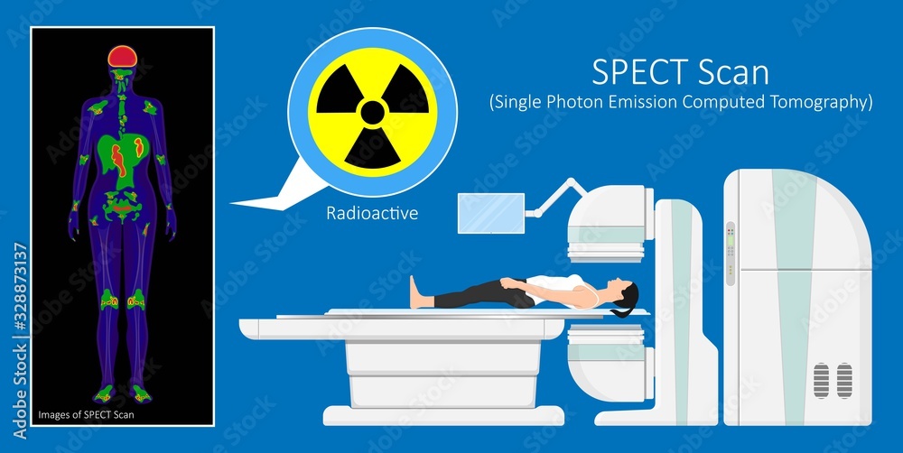 SPECT scan radiologist single computed image CT PET 3D radiotracer ...