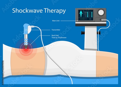 Shockwave therapy SWT physiotherapist treat muscular disorder back neck physical tennis Elbow muscle stimulator ultrasound calcific tendonitis