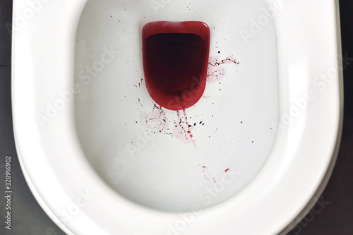 Valokuva Blood in toilet bowl, Rectal bleeding from hemorrhage, Blood in urine, Health warning sign for serious disease symptom