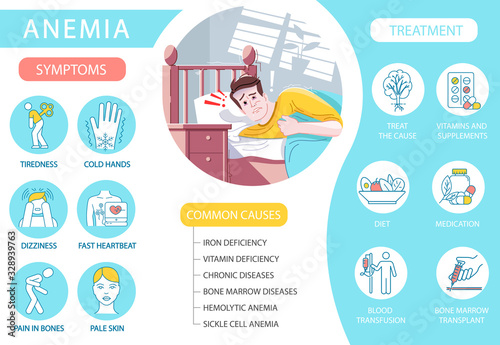 Anemia vector infographic template. Anaemia common causes and symptoms. Patient UI web banner with flat characters. Chronic disease treatment. Cartoon advertising flyer, leaflet, ppt info poster idea