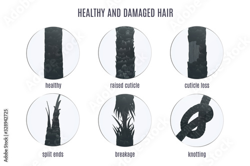 Damaged hair surface under microscope. Hair follicle structure condition closeup vector set. Problem of split ends, breakage, knotting, raised cuticle and loss of cuticle. Trichology medical concept. photo