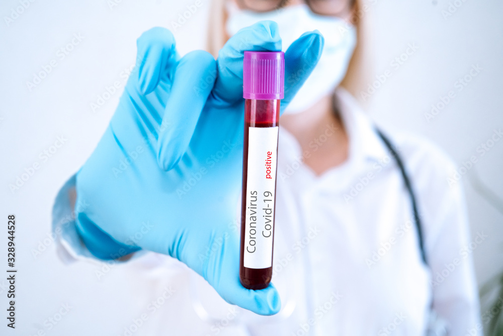 Doctor hand in medical glove  holding tube with positive blood test result for rapidly spreading Coronavirus 2019-nCoV in laboratory.  Coronavirus  Covid-19 outbreaking. Medicine and epidemic concept.