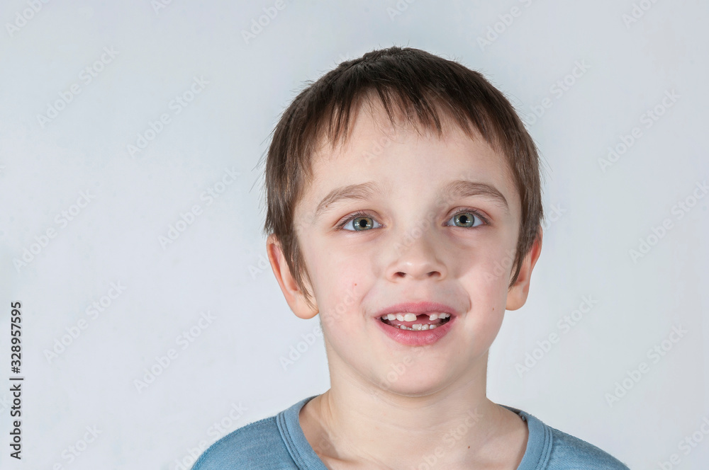 The boy is smiling. He has no anterior tooth The boy is smiling. He has no anterior tooth