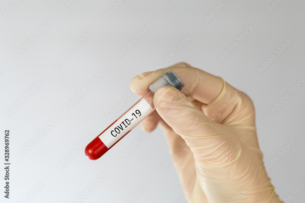Obraz premium Laboratory sample of blood testing for diagnosis new Corona virus infection (COVID-19) from Wuhan, China. Pandemic infectious concept.