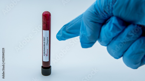 Laboratory technician hand hold blood sample tube for corona virus test